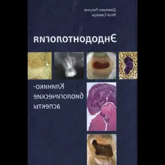 Книга Эндодонтология. Клиникобиологические аспекты Д. Рикуччи, Ж. Сикейра