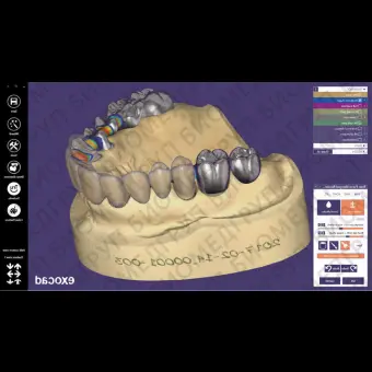 Клиническое программное обеспечение exocad 