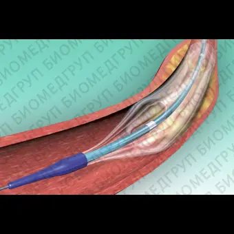 Катетер PTCA POWERLINE