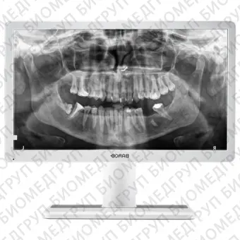 Barco Eonis 22 MDRC2222 Option WP Dental Медицинский монитор