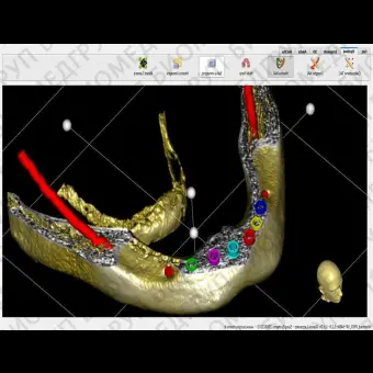 Хирургическое программное обеспечение Winmed
