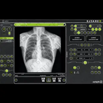 Программное обеспечение для медицинских снимков ERACLE