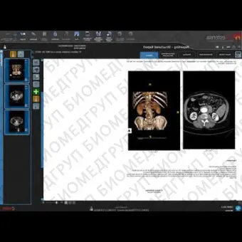Программное обеспечение для медицинских снимков SUITESTENSA RIS PACS