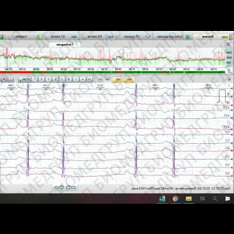 Кардиомонитор Холтера 12 каналов CloudHolter 3/12