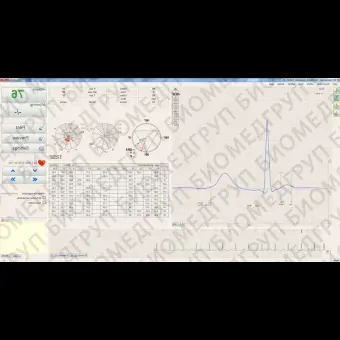 Электрокардиограф для спокойного состояния BTL CardioPointECG C600