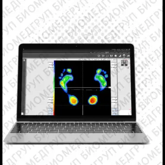 Переносная стабилометрическая платформа PODOPRINT WIFI