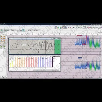 Монитор пациента для ЭЭГ EEGDigiTrack CFM