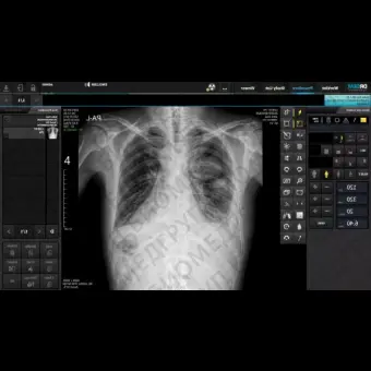 Redikom Рентгенодиагностическая система