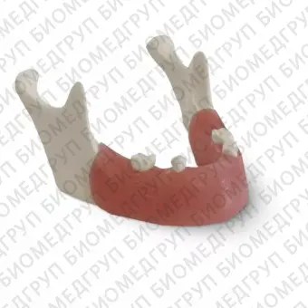 E82 модель нижней челюсти для практики установки имплантатов