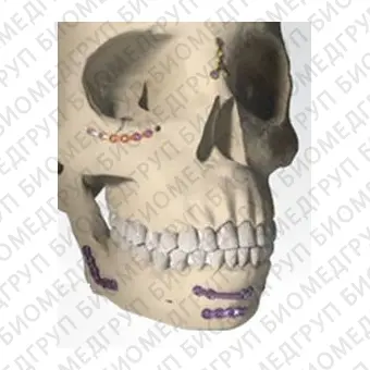 Компрессионная костная пластина для челюстнолицевого восстановления ORTRAUTEK Trauma 2.0