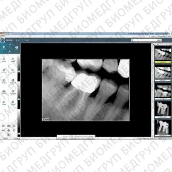 Программное обеспечение для обработки снимков зубов Visiodent