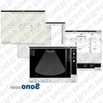 Ультразвуковой сканер на платформе Sonoview