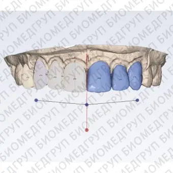 Программное обеспечение для стоматологии Planmeca Romexis Smile Design